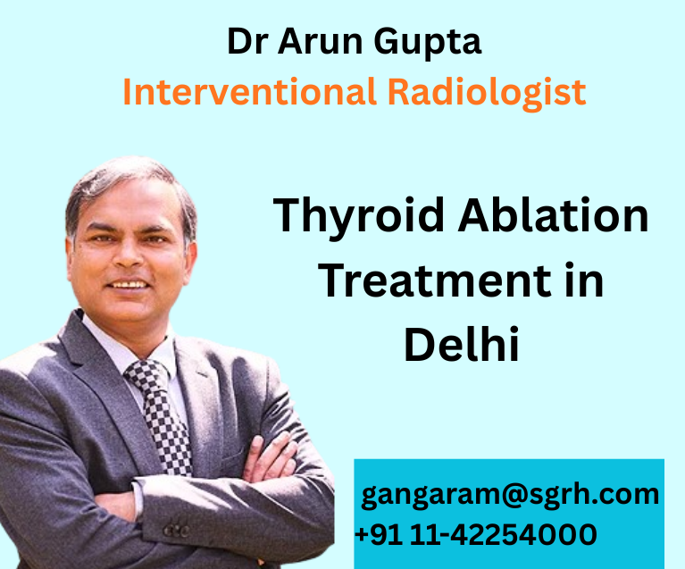 Thyroid Ablation Treatment in Delhi