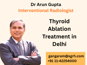 Thyroid Ablation Treatment in Delhi
