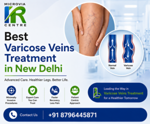 Best Varicose Veins Treatment in New Delhi