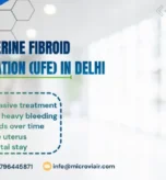 Uterine Fibroid Embolization (UFE) in Delhi