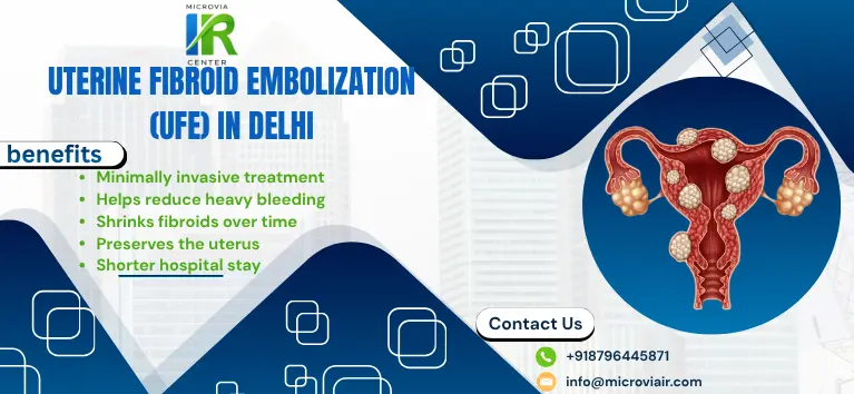 Uterine Fibroid Embolization (UFE) in Delhi
