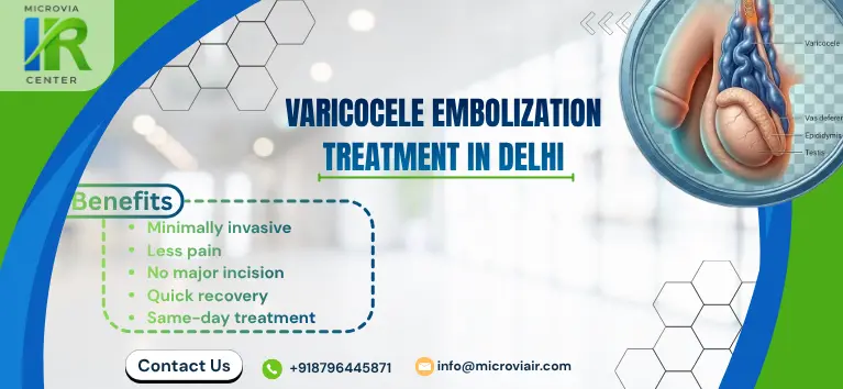 Varicocele Embolization Treatment in Delhi