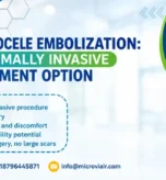Varicocele Embolization: A Minimally Invasive Treatment Option