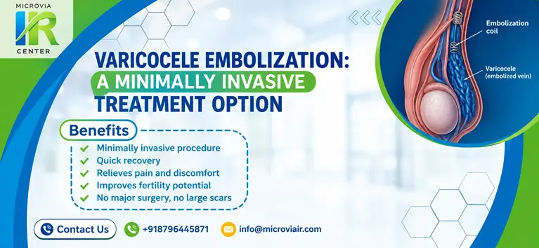 Varicocele Embolization: A Minimally Invasive Treatment Option