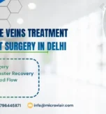 Varicose Veins Treatment Without Surgery in Delhi