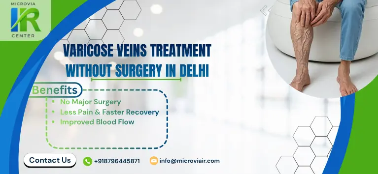 Varicose Veins Treatment Without Surgery in Delhi